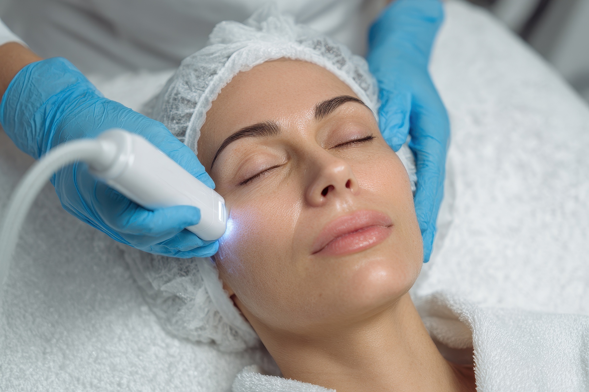 Microneedling Treatments