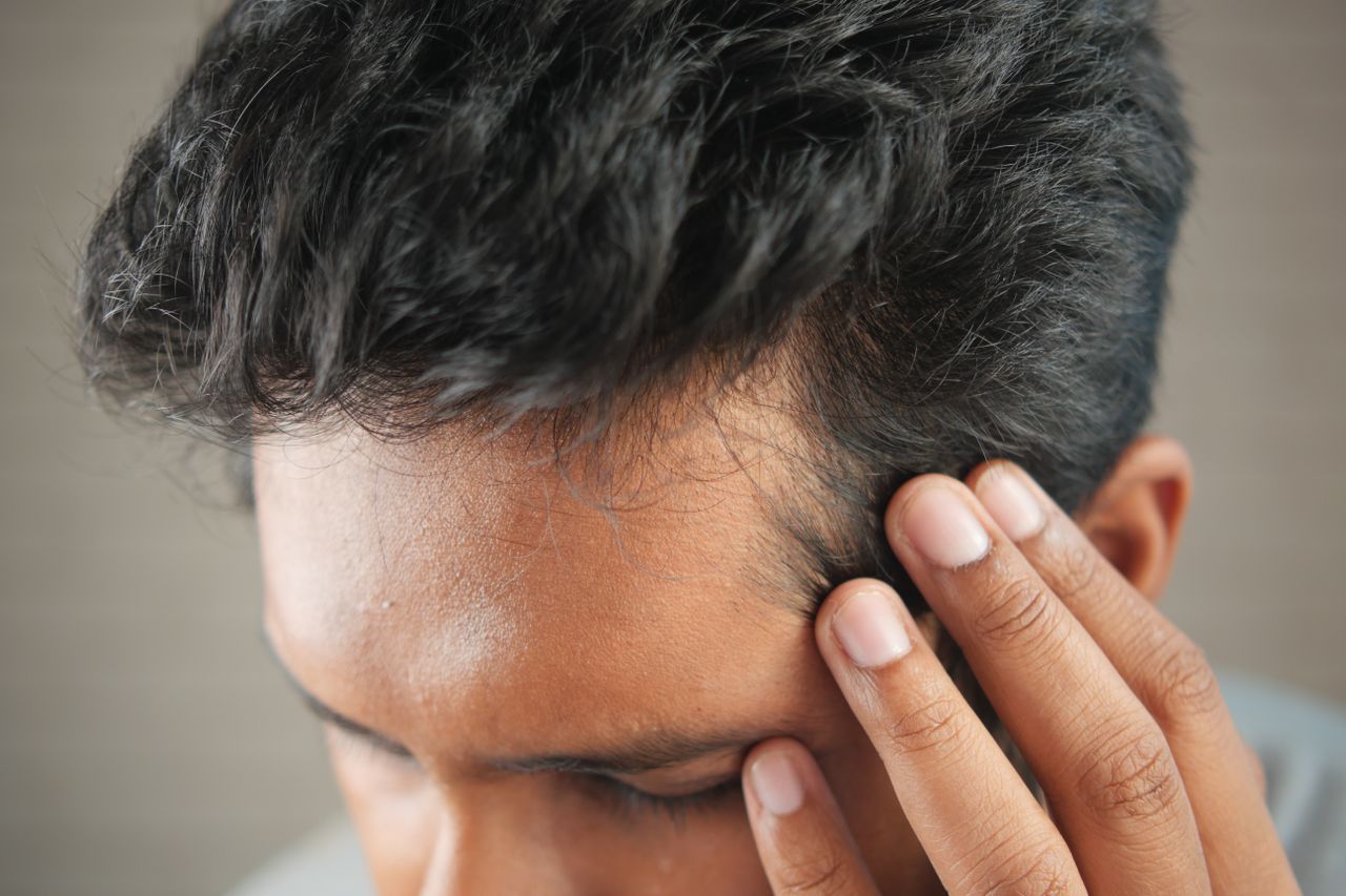 Hair Restoration